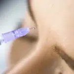 Inyección botox